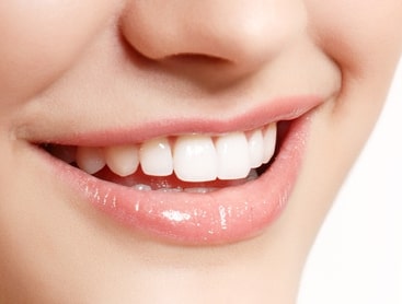 患者様の要望に合わせたホワイトニング