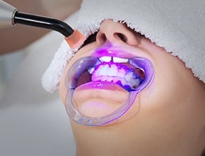 オフィスホワイトニング