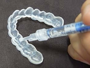 ホームホワイトニング